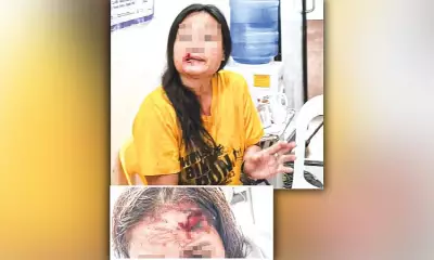 Woman's Forehead Flesh Torn in Bizarre Biting Attack in Cebu