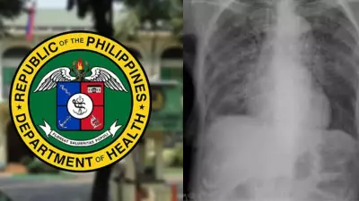 DOH Reiterates Call for Early TB Screening to Combat Spread on World TB Day