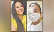 Andrea Del Rosario Undergoes Eye Surgery After Makeup-Related Infection