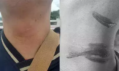 Davao City Councilor Urges Kite Safety Rules After Rider Injured