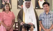 Saudi Arabia Successfully Separates Filipino Conjoined Twins After 13-Hour Surgery