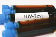 Philippines Reports 51 New HIV Cases Daily in First Quarter of 2026