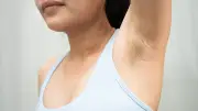 Dear Dr. Fritz: How to tell my girlfriend about her armpit odor