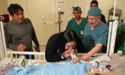 Filipino conjoined twins Olivia and Gianna successfully separated in Saudi Arabia