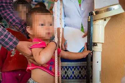 Cebu City Child Malnutrition Persists Despite Interventions, Budget Shortfall Cited